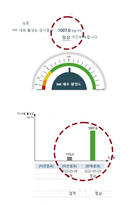 면역력 수치변화
