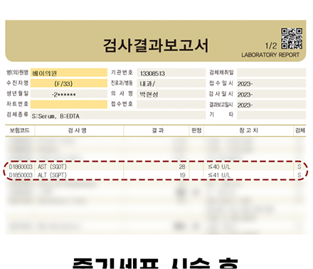 간수치변화