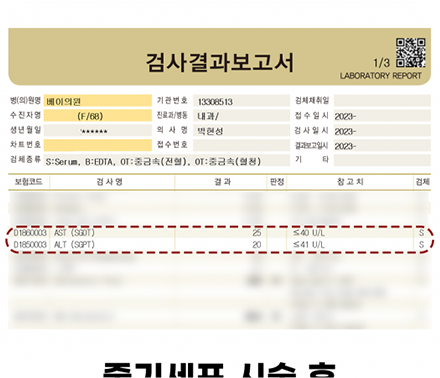 간수치변화