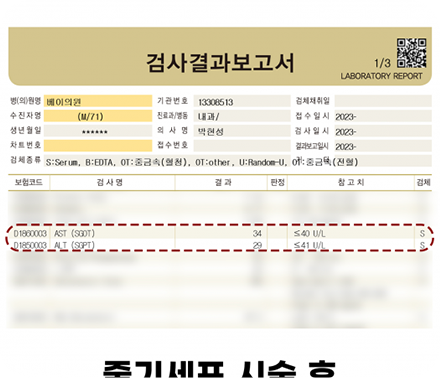 간수치변화