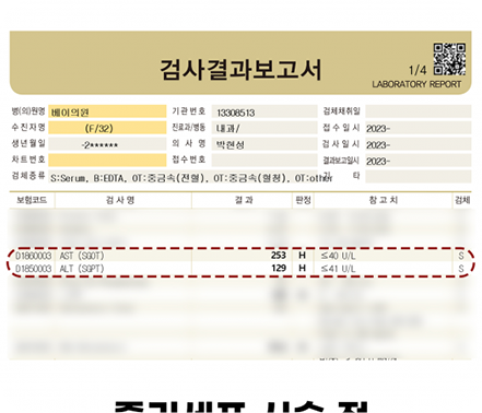 간수치변화