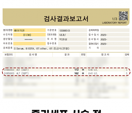 간수치변화