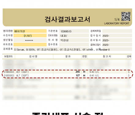 간수치변화