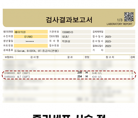 간수치변화