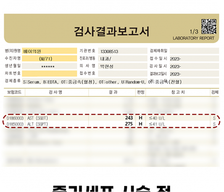 간수치변화