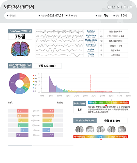 스트레스 수치 변화