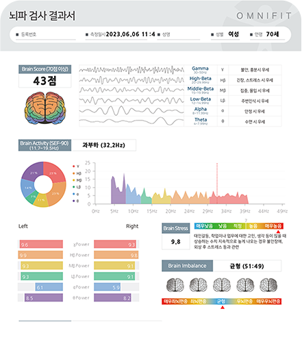 스트레스 수치 변화